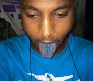 A drug user displays a blue tongue from repeated use of narcotics.